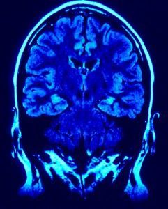 Pruebas de Neuroimagen